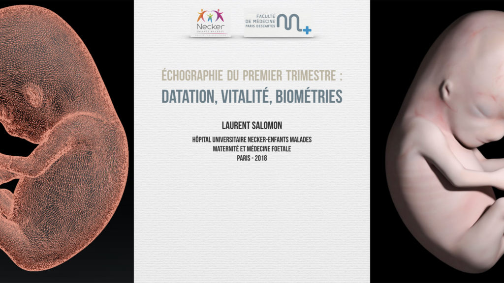 Échographie T1 : datation, vitalité, biométries