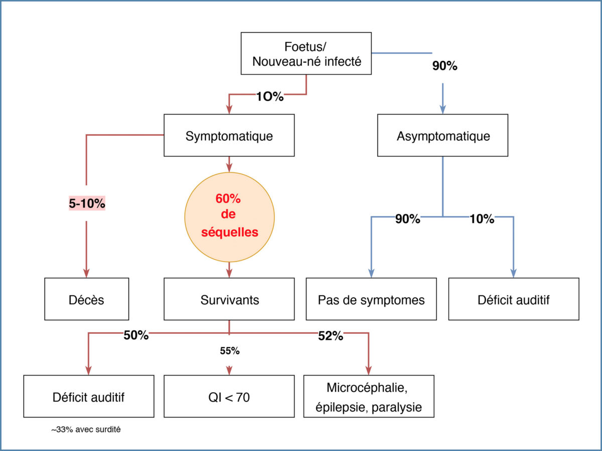 INFECTION CONGÉNITALE À CYTOMEGALOVIRUS