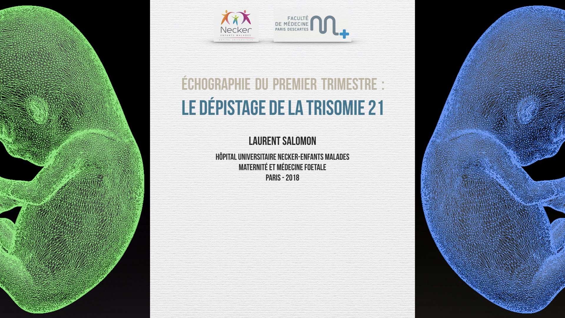 Dépistage de la trisomie 21