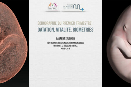 Échographie T1 : datation, vitalité, biométries