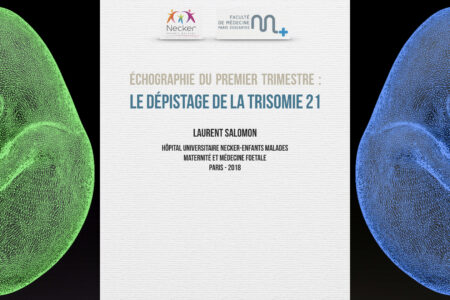 Dépistage de la trisomie 21