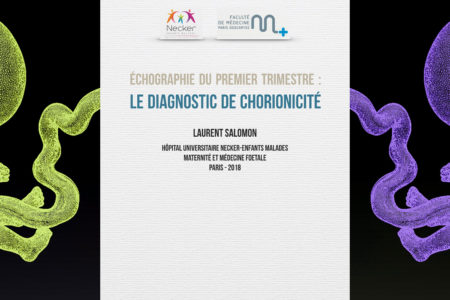 Grossesses gémellaires et chorionicité